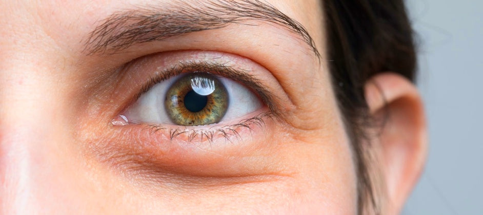 These Are The Best Ingredients For Fighting Dark Circles