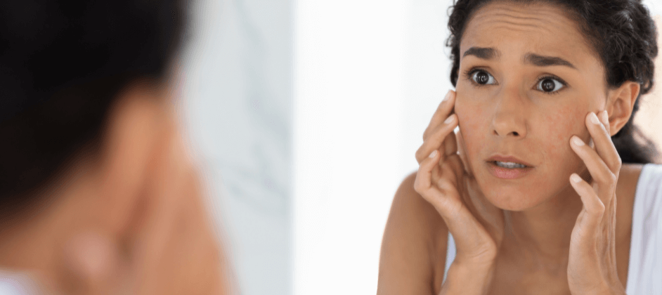 3 Signs Your Skin Is In Desperate Need Of A Reset
