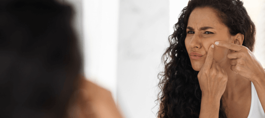 3 Unexpected Triggers Of Adult Acne And How To Address Them