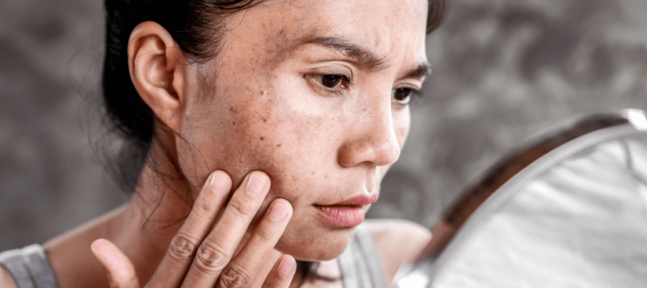5 Reasons Damaged Skin Ages Faster Than Usual
