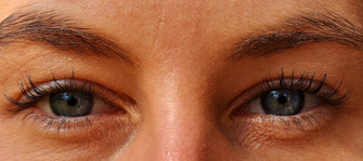 Here’s Why You Should Use A Serum Instead of Cream Around Your Eyes