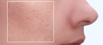 How to Keep Your Pores Clear (Without Stripping Your Skin)