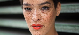 Three Things You Should Never Do To Your Dark Spots