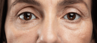 3 Healthy Habits That Will Banish Dark Circles From Your Appearance