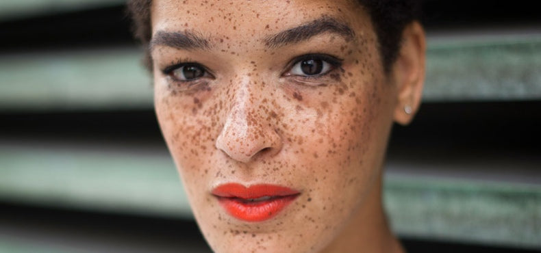 Three Places To Fight Dark Spots Other Than Your Face