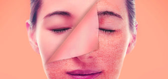 What Happens To Your Skin If You Skip A Day of Moisturizer?