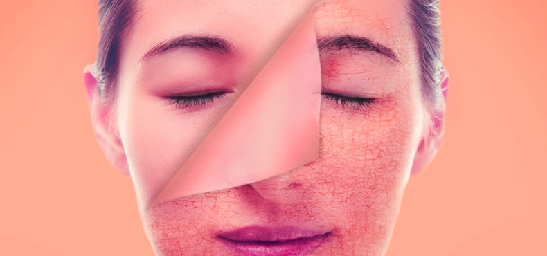 What Happens To Your Skin If You Skip A Day of Moisturizer?