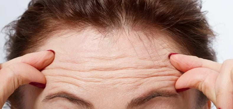 Banish Visible Forehead Lines With These Three Simple Steps