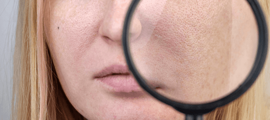 Myth: You Can Shrink Your Pore Size. Is It True?
