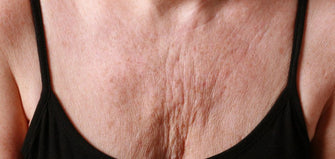 Your Neck And Chest Are Giving Your Age Away But We Know How To Stop It