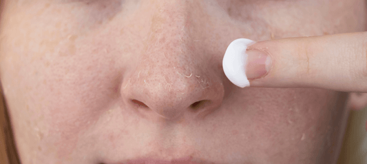 5 Signs Your Skin Needs More Hydration