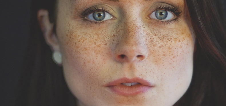 What Is Causing Your Sunspots And How To Stop Them From Appearing