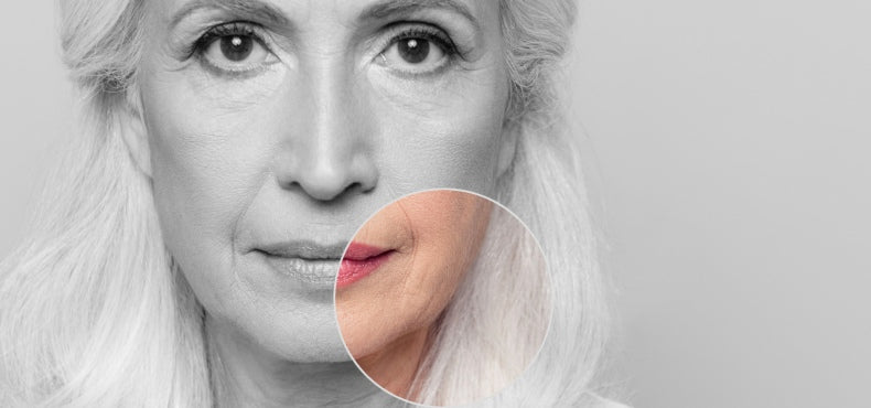 These Are The Most Stubborn Types of Wrinkles To Reverse